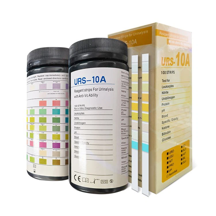 Urine Analiysis Test